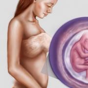 Причины тошноты и рвоты перед родами, во время беременности Рвота на 36 неделе беременности причины